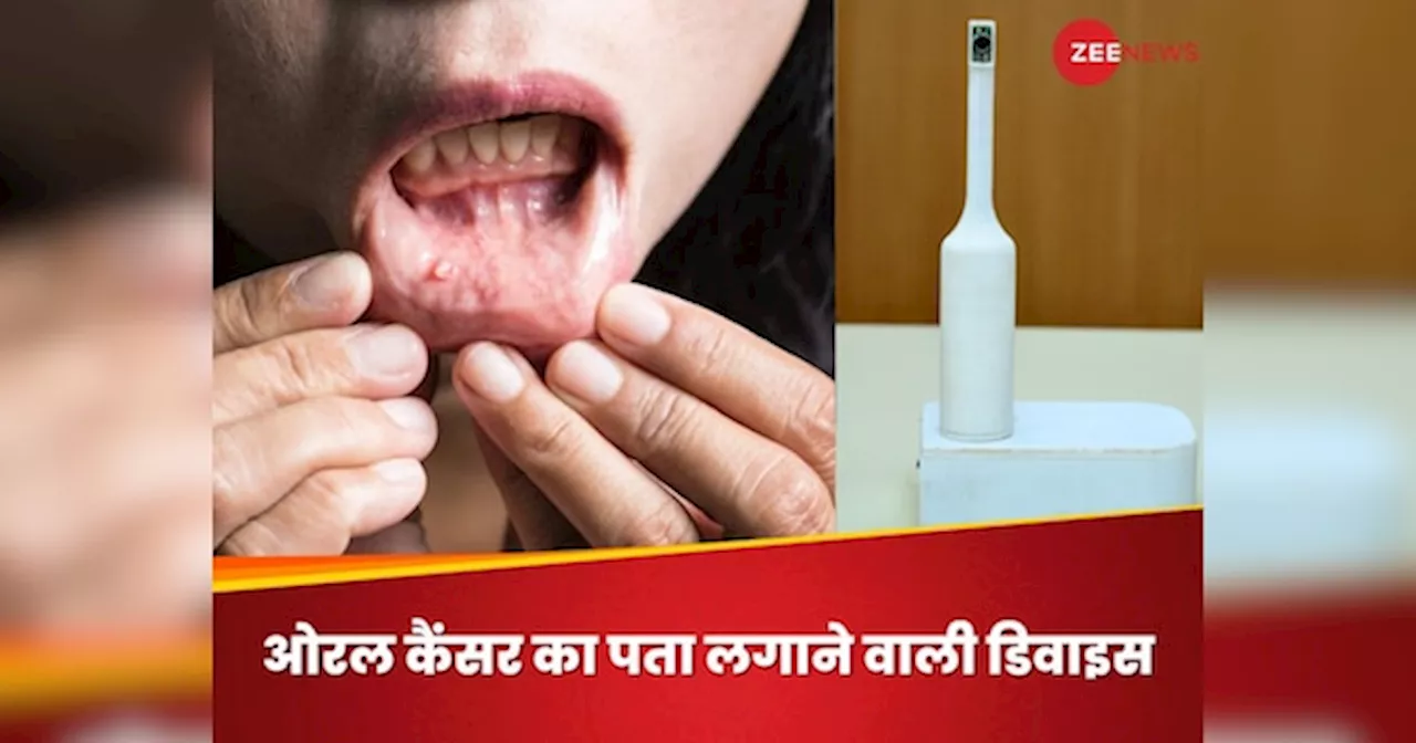 Mouth Cancer का पता लगाएगा टूथब्रश, जल्द बाजार में आएगी IIT Kanpur में बनी ये डिवाइस