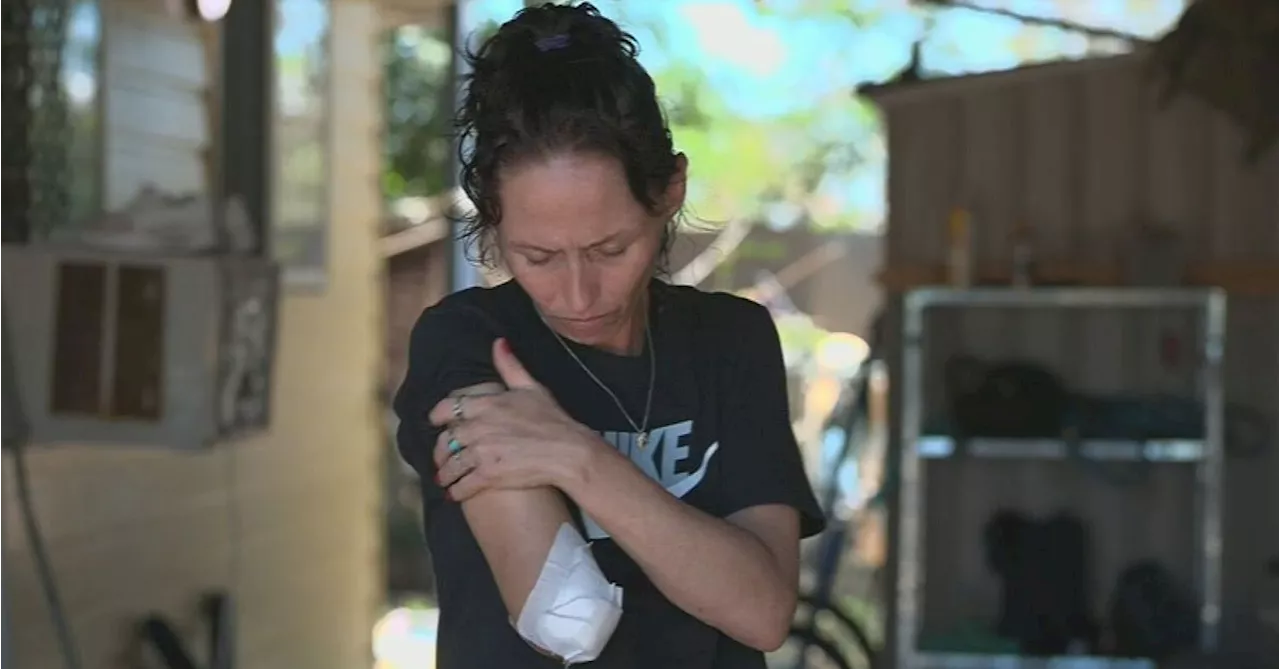 Queensland mum says she doesn't blame her dog after he ripped her arm off