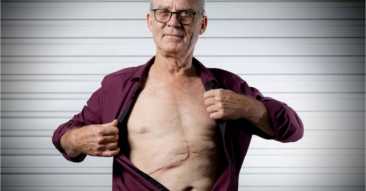 Surgeon removes tumour as heavy as a bag of sugar from man who had no symptoms