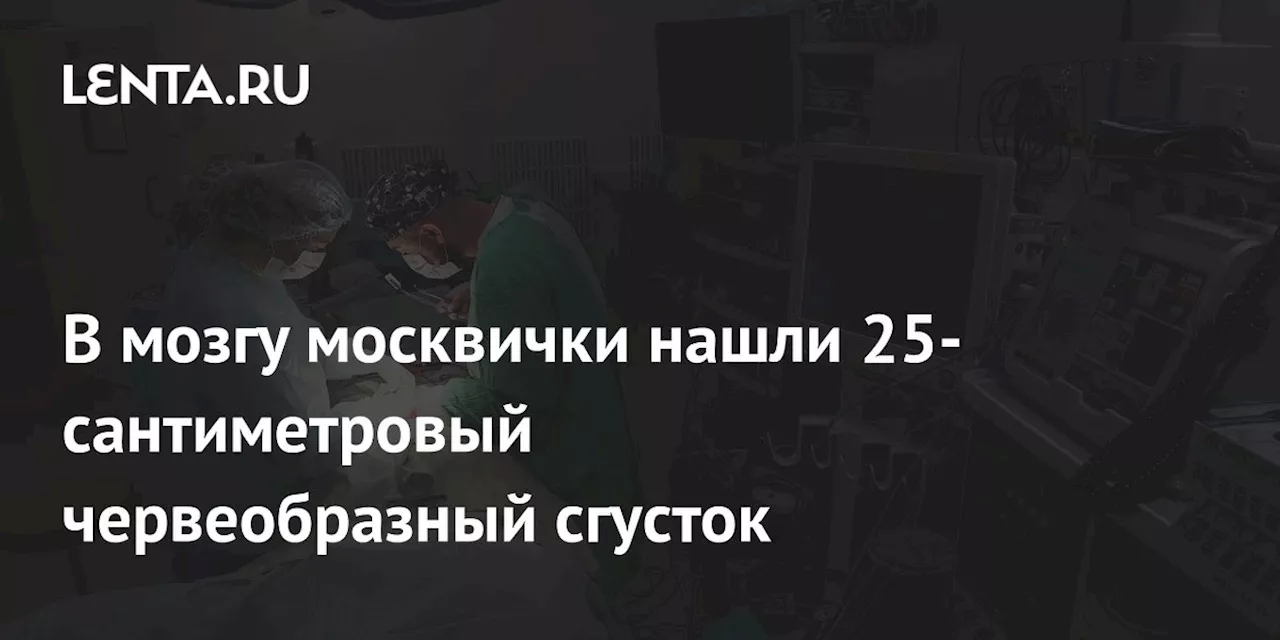 В мозгу москвички нашли 25-сантиметровый червеобразный сгусток