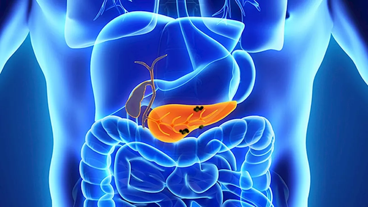 AI Tool Helps Detect, Differentiate Pancreatic Lesions During Endoscopic Ultrasound