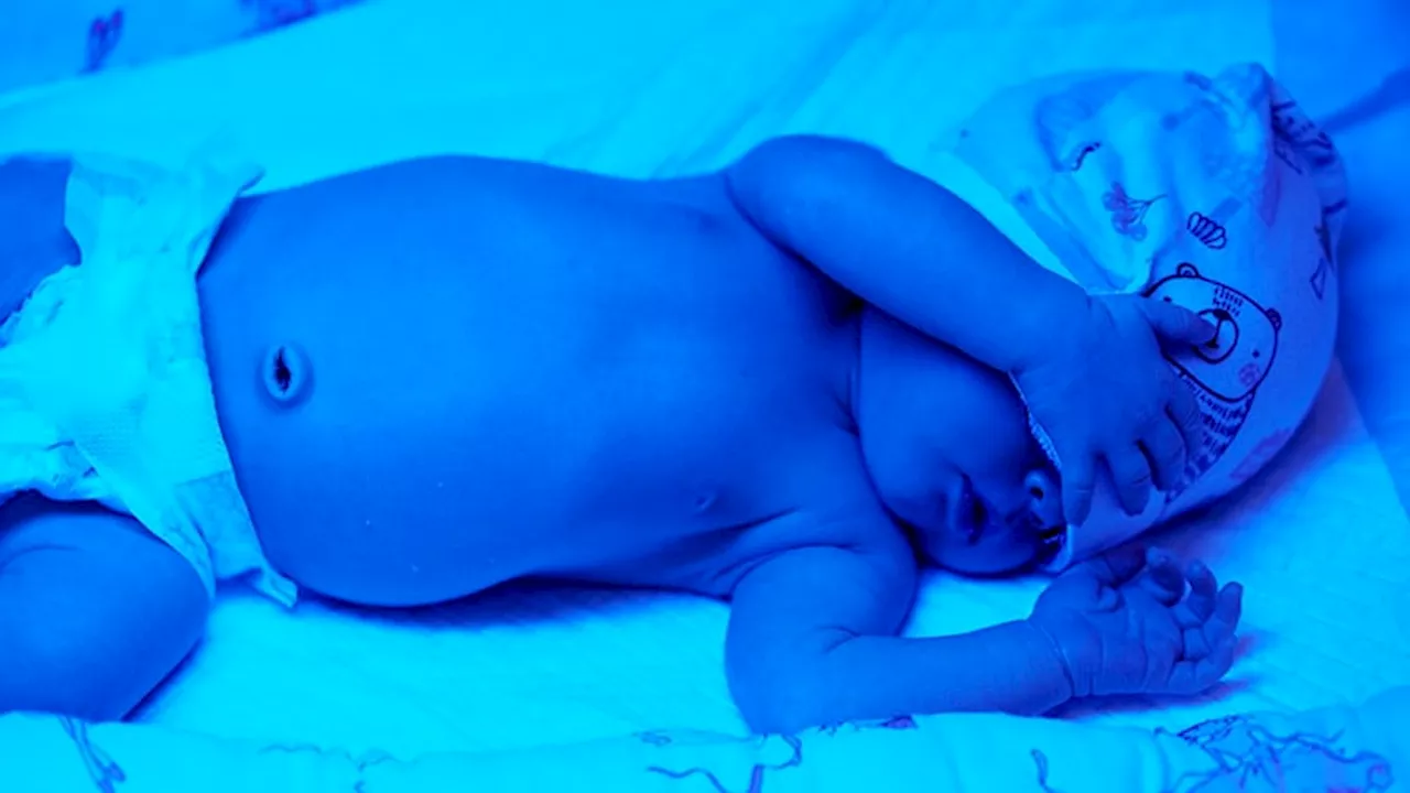 Early Bilirubin Screening Identifies Neonates Needing Phototherapy