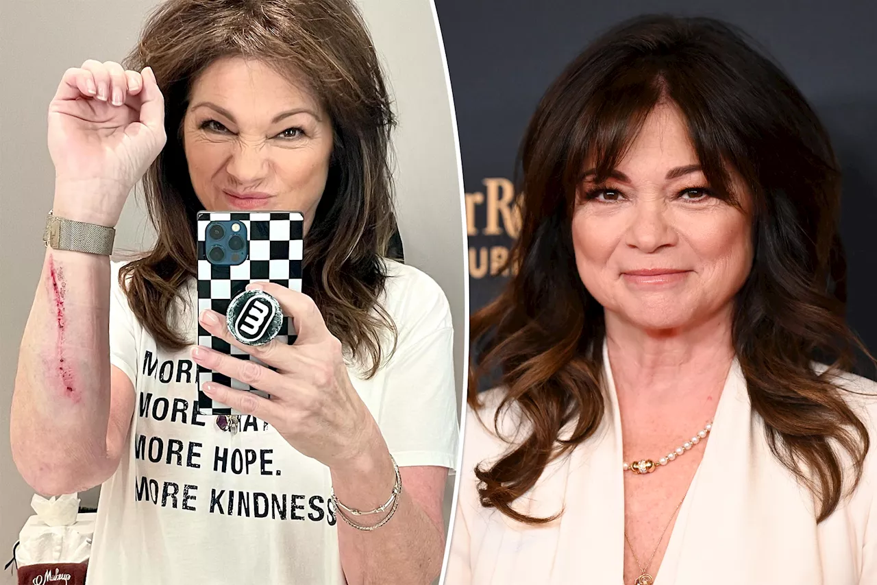 Valerie Bertinelli reveals brutal injury after tripping on a stage: ‘My own damn fault’