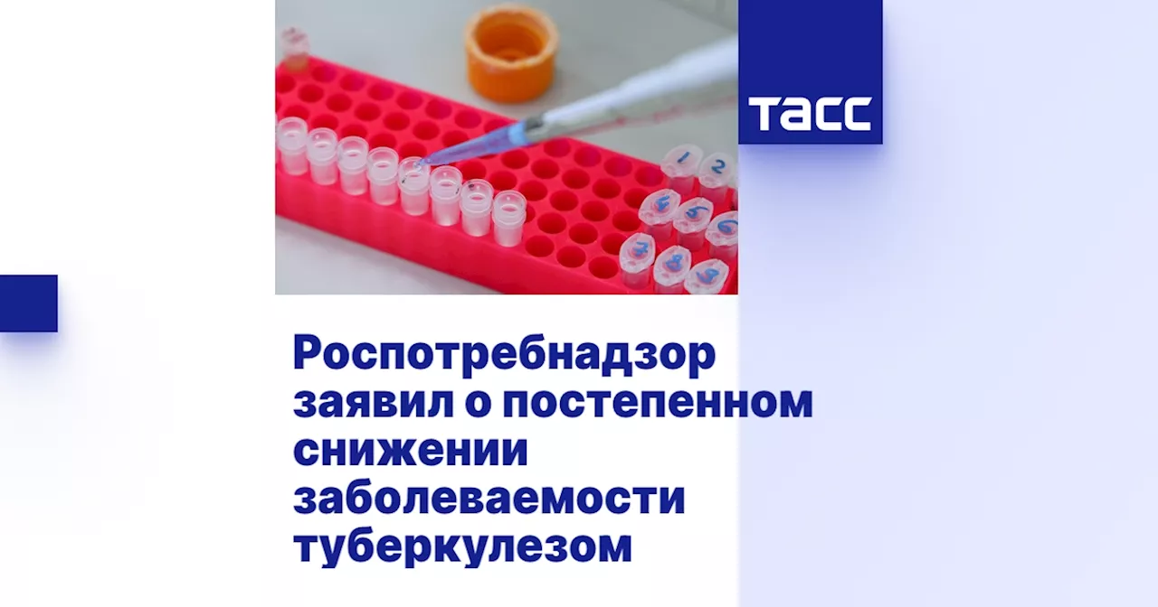 Роспотребнадзор заявил о постепенном снижении заболеваемости туберкулезом