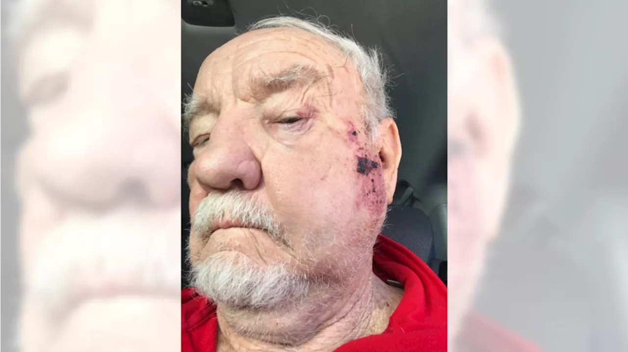 Video shows ‘unprovoked’ attack of 80-year-old Redondo Beach Elks Lodge member