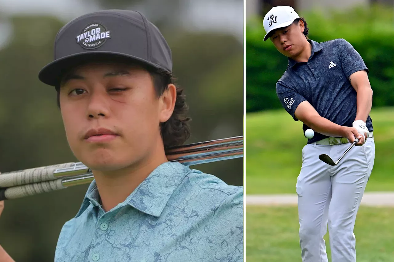 Golfing prodigy Jeffrey Guan blinded in left eye after freak pro-am accident