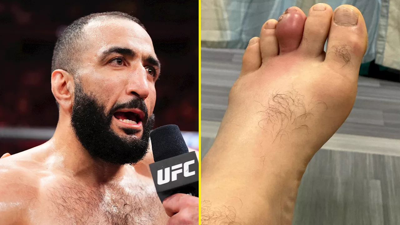 Conor McGregor reacts to champion’s grotesque foot infection as Alex Pereira ‘approached’ for UFC 310...