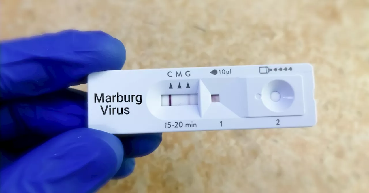 Why is the CDC warning about the Marburg virus disease outbreak in Rwanda?