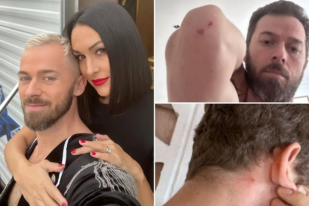 ‘DWTS’ pro Artem Chigvintsev seeks protective order against Nikki Bella, reveals bloody injury photos from alleged altercation