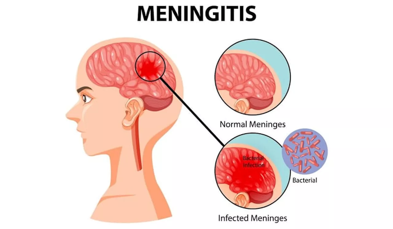 Hari Meningitis Sedunia Sejarah, Maksud dan Tujuan