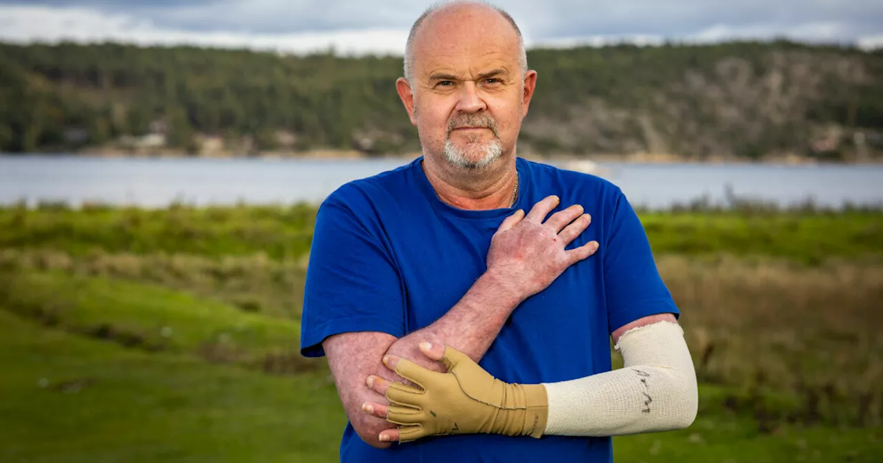  Jeg var plutselig fanget i et flammehelvete