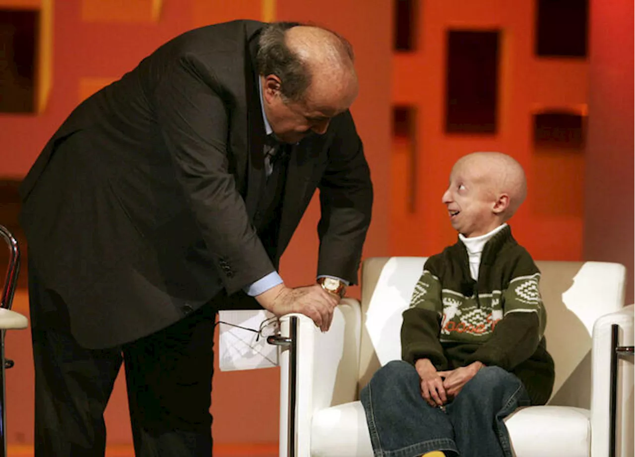 Che cosa è la progeria, la malattia che aveva Sammy Basso