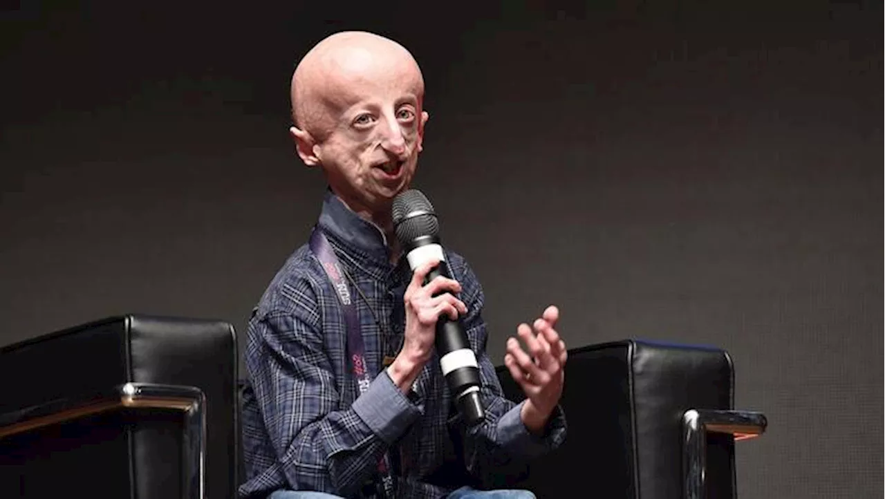 Sammy simbolo della progeria, brucia la giovinezza