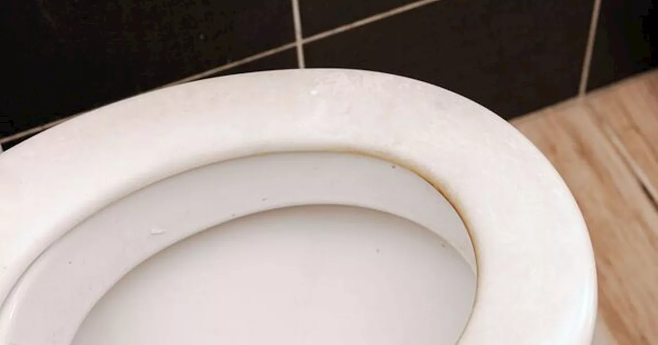 Mrs Hinch Fans Warn Against Bleach For Yellowing Toilet Seats