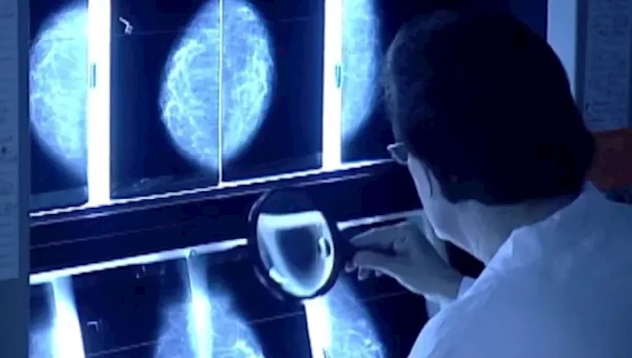New study shows early detection key to beating breast cancer. It echoes Nassau teacher’s survival story