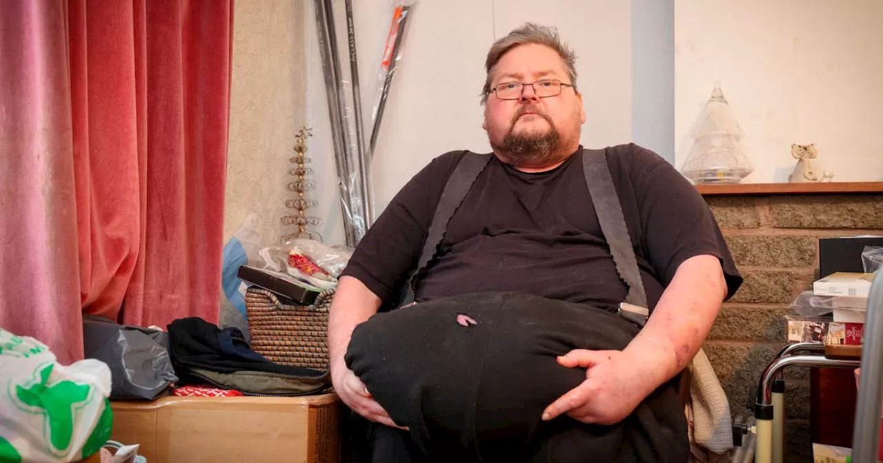 Man with five-stone growth on his stomach told NHS won't pay for surgery