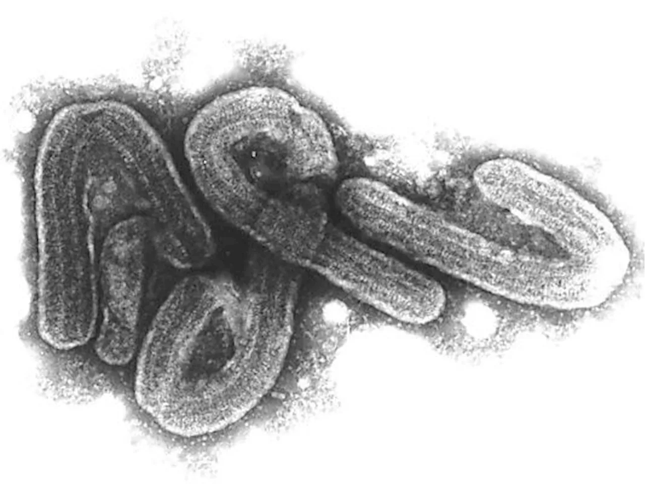 Versuchsimpfungen gegen Marburg-Virus in Ruanda gestartet