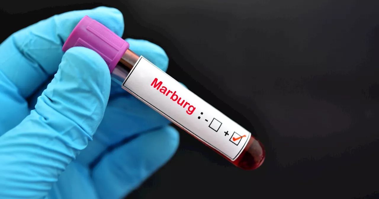 CDC to begin screening some travelers for Marburg virus disease