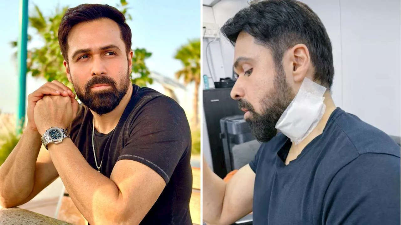 Emraan Hashmi Injured: शूटिंग के वक्त घायल हुए इमरान हाशमी, 45 वर्षीय एक्टर की गर्दन पर लगी गंभीर चोट