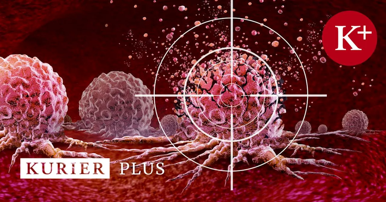 Erfolgsgeschichte: Wie die moderne Medizin dem Krebs auf der Spur ist