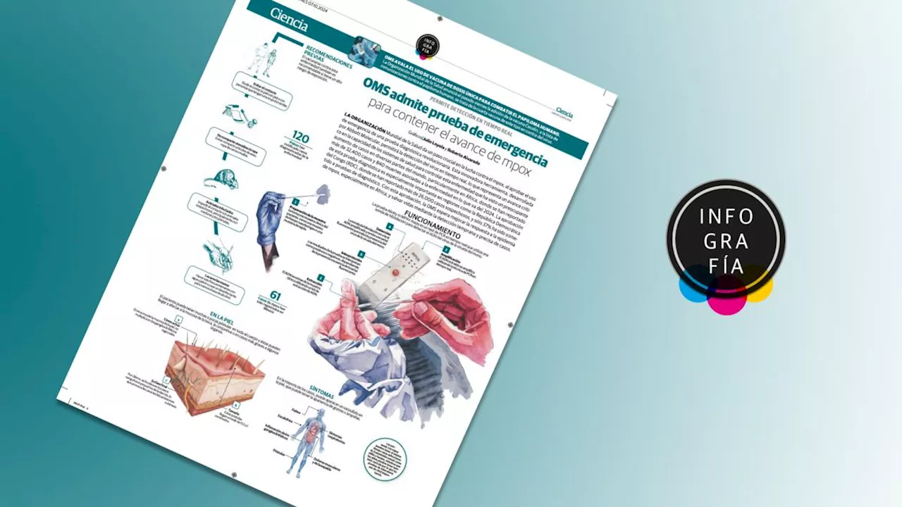 OMS admite prueba de emergencia para contener el avance de mpox