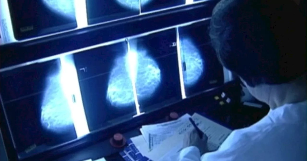 Ontario lowers the age for self-referral mammogram breast screening to age 40