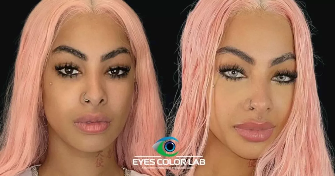 Yailin La Más Viral cambia el color de sus ojos con cirugía