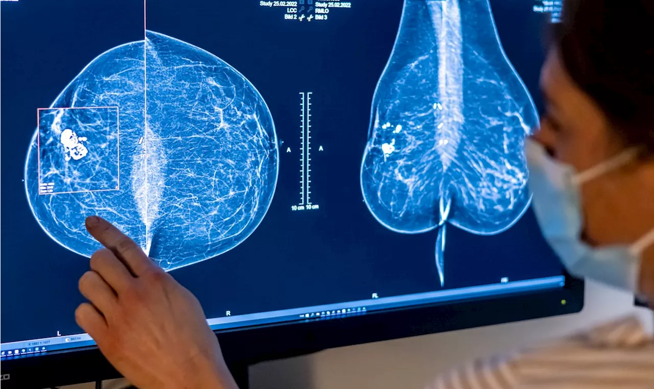 Breast cancer screenings now easier to access at age 40 in most of Canada, though experts warn of more false positives