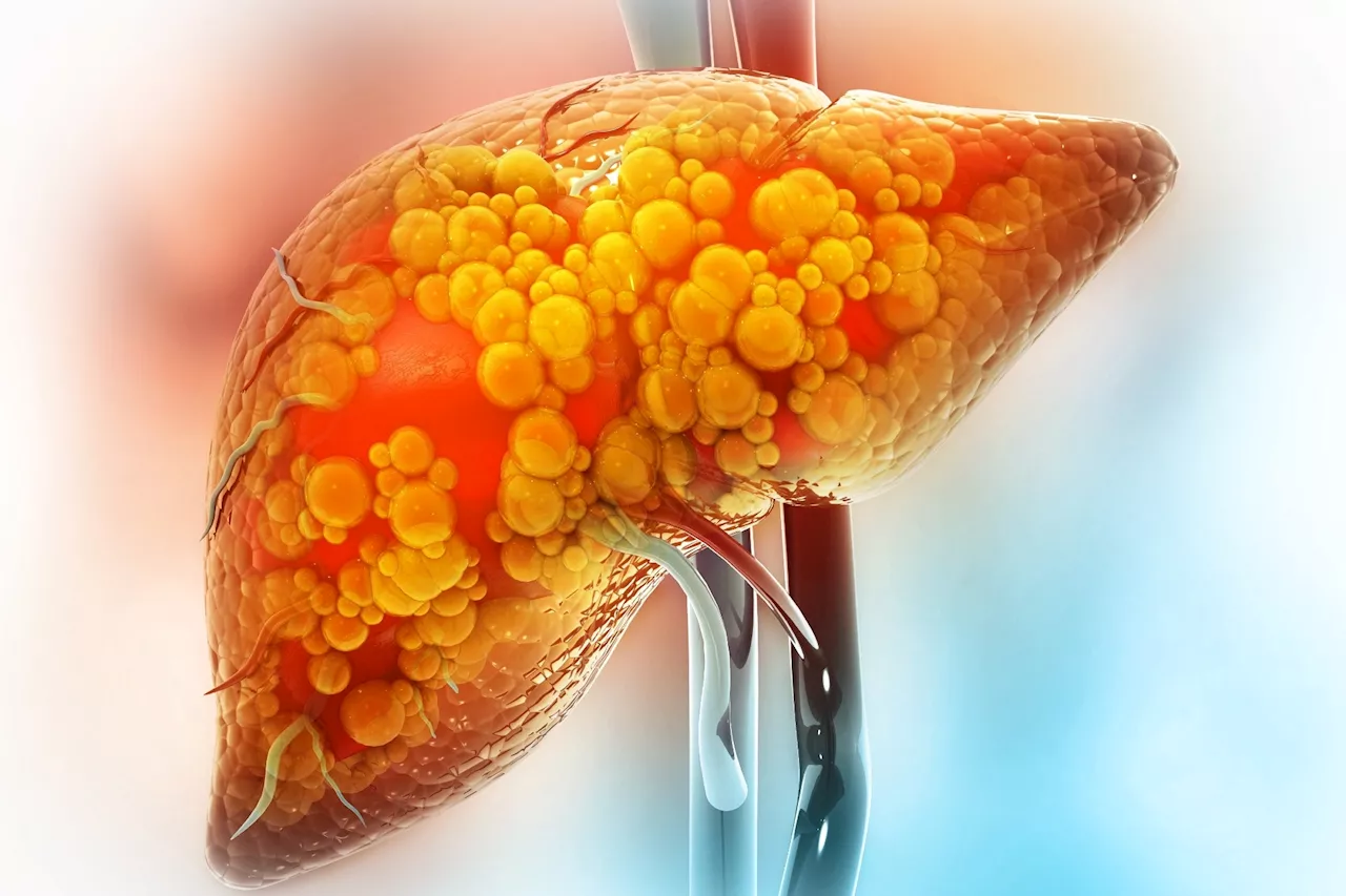 Researchers uncover how senescent cells can both harm and heal in liver disease