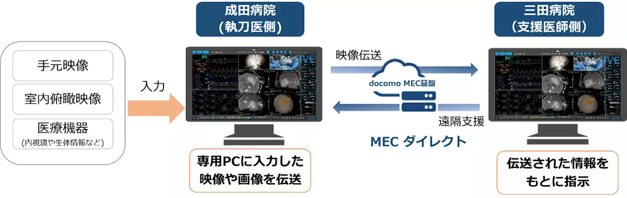 手術記録システム「OPeDrive」と「MECダイレクト🄬」を用いた遠隔手術支援および手術映像の教育活用の実証実験に成功