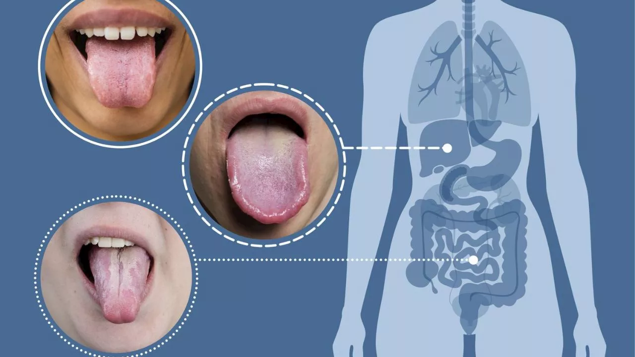 Unhealthy Tongue Colour: నాలుక రంగు బట్టి మీ వ్యాధి గురించి తెలుసుకోవచ్చు..!