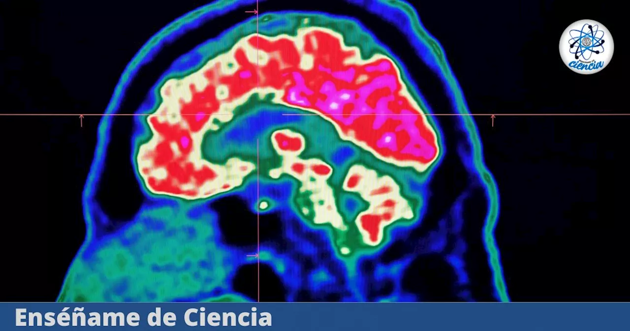 Esta mujer jugó con su propio cerebro, y al ver sus tomografías no pudo creer lo que descubrió