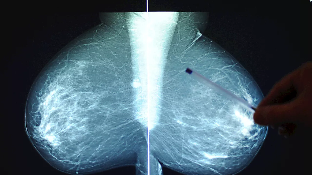 Viel zu wenig Krebs-Früherkennung in Österreich