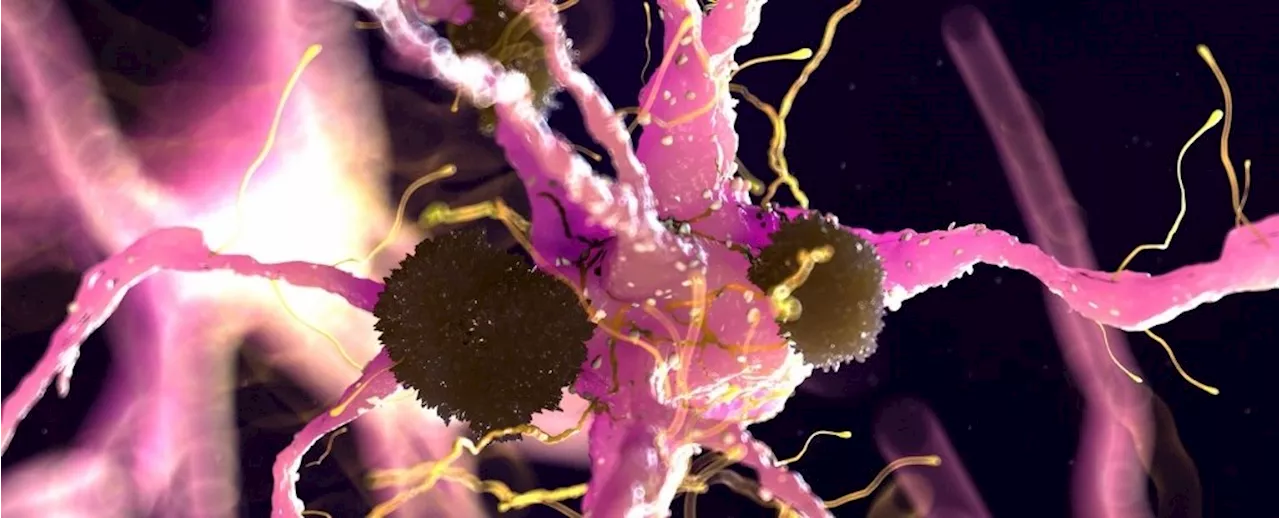 Parkinson's Discovery Suggests We Already Have an FDA-Approved Treatment