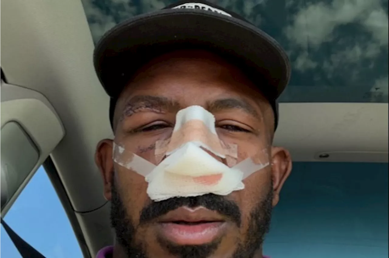 – Khalil Rountree Jr reveals brutal post-surgery damage caused by Alex Pereira at UFC 307...