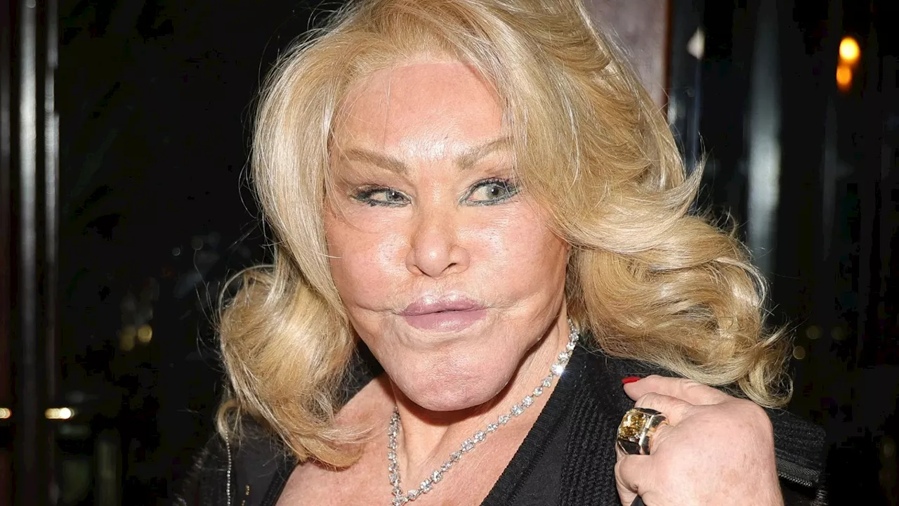 Kattkvinnan" Jocelyn Wildenstein Har Avlidit Vid 84 Års Ålder