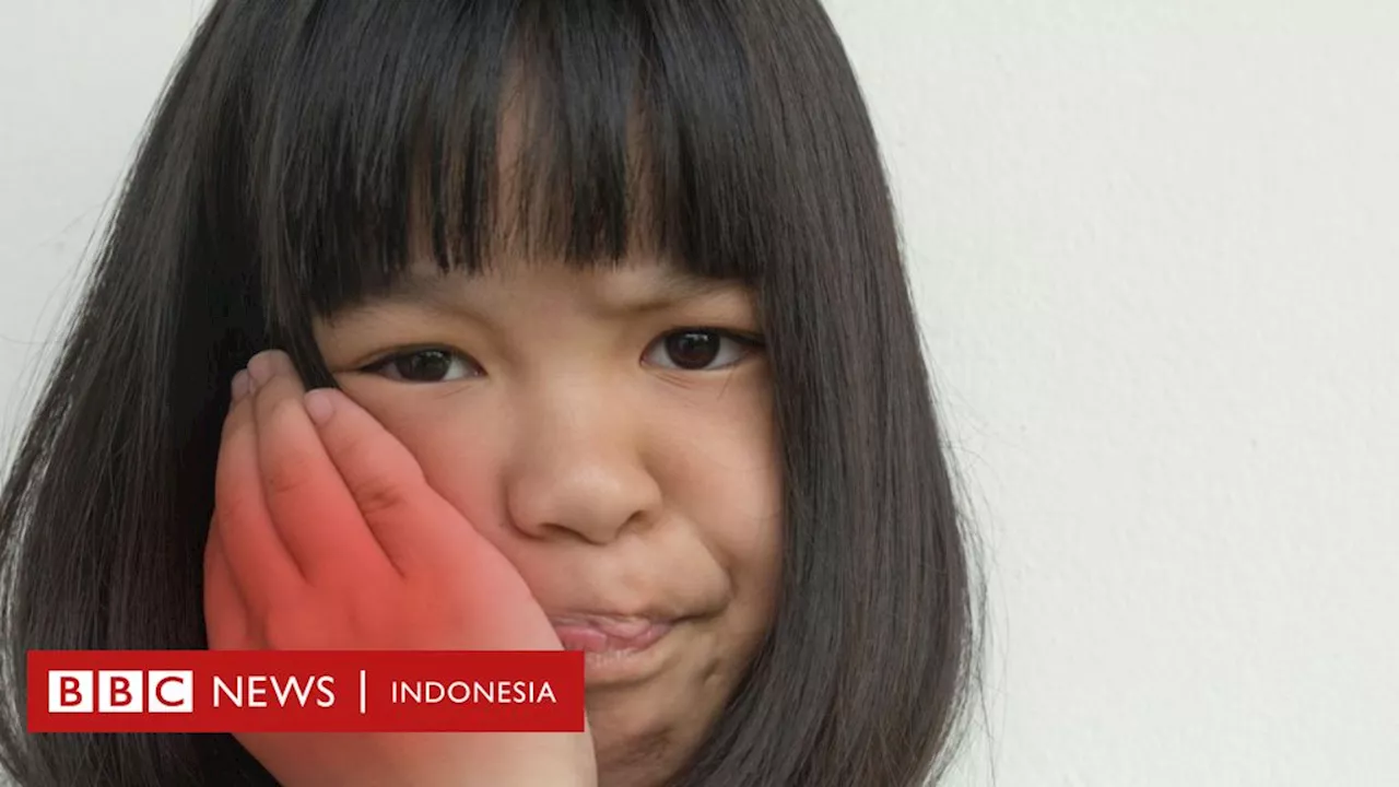 Penyakit mumps: Ribuan anak terinfeksi penyakit gondongan – Apa itu gondongan, bagaimana cara penularan dan apakah berbahaya?