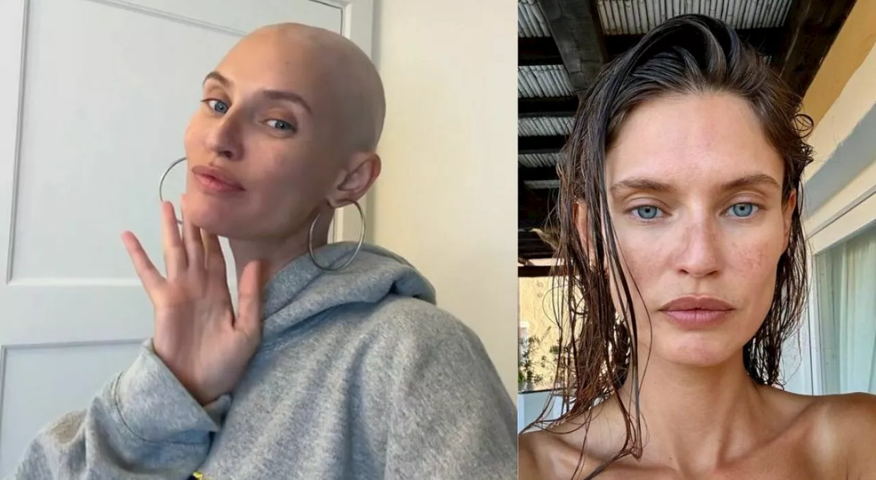 Bianca Balti si mostra per la prima volta senza capelli: «Sempre una “bad bitch”». Come sta dopo il tumore ova