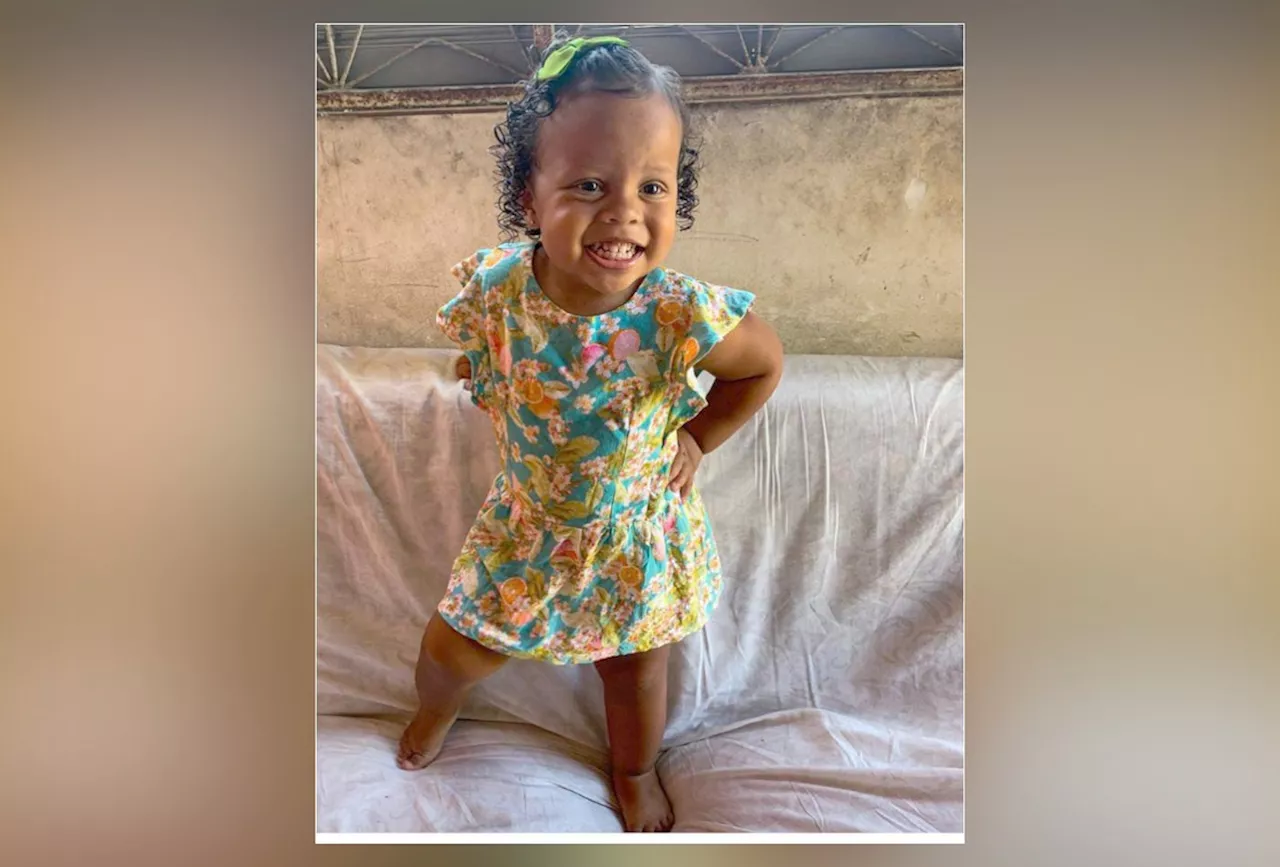 Menina de 3 anos baleada na Baixada Fluminense apresenta evolução em seu quadro, que segue grave