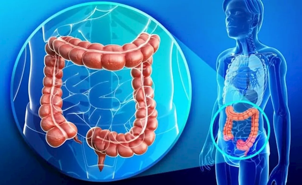 Deteksi Kanker Usus dengan Virtual Colonoscopy, Nyaman dan Cepat