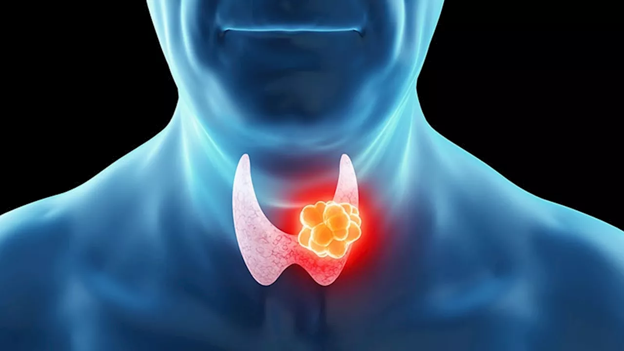 ATA: Updates on Risk, Diagnosis, and Treatment of Thyroid Cancer