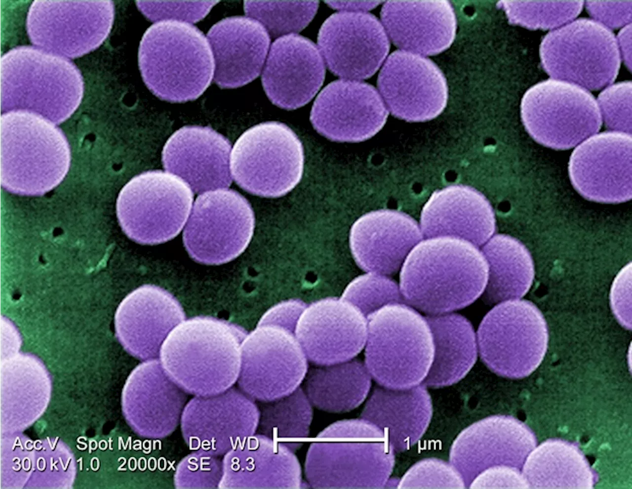 Scientists uncover new MRSA resistance mechanism