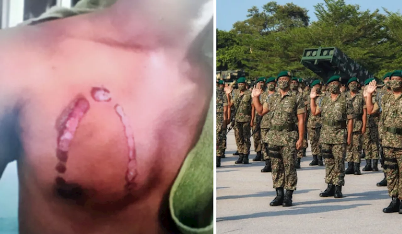 Malaysians Horrified At Yet Another “Iron Bully” Case Involving UPNM Cadets