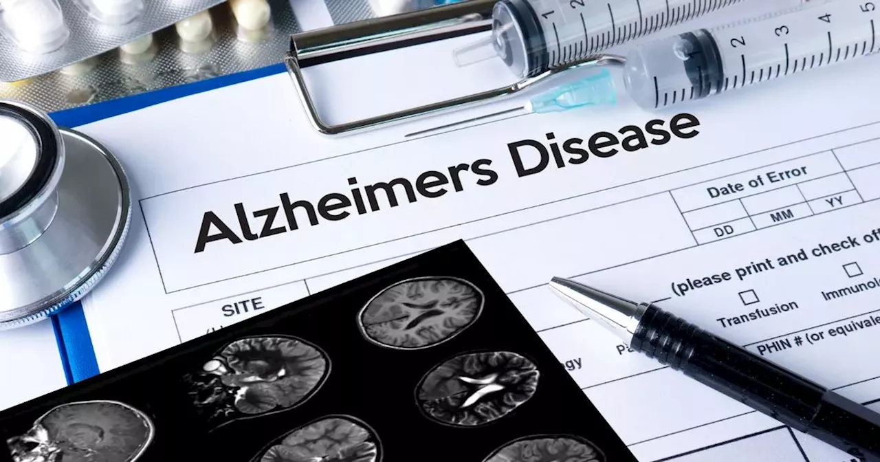 Alzheimer’s disease associated with 10 health conditions