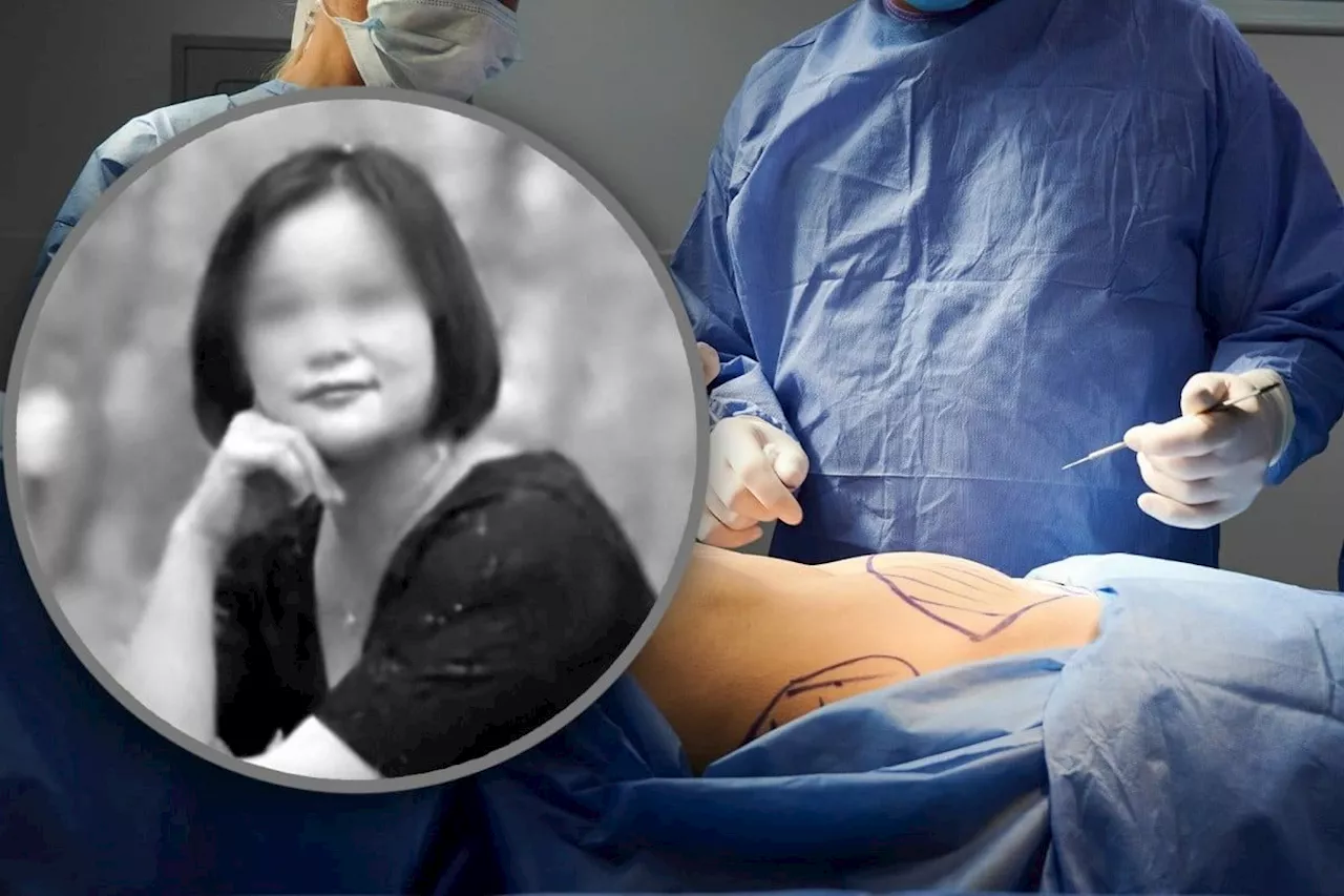 China woman dies after six cosmetic surgeries in a day, family gets half of US$168,000 sought