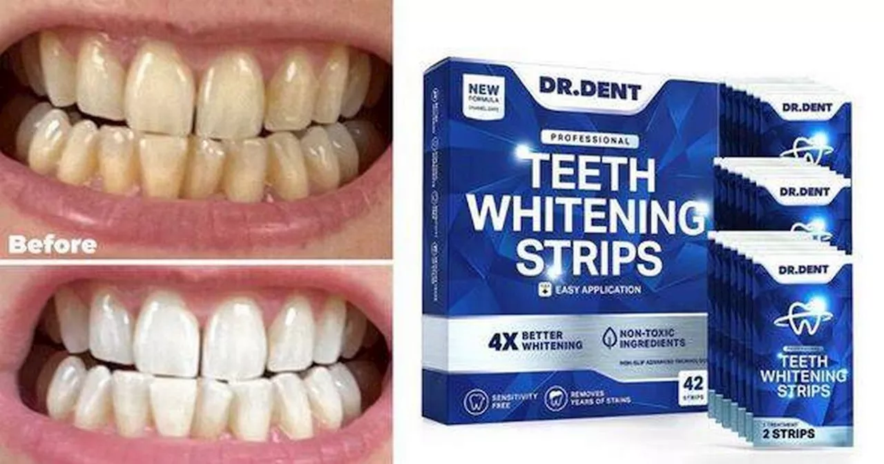 Shoppers get compliments on white teeth after using Amazon pre-Black Friday buy