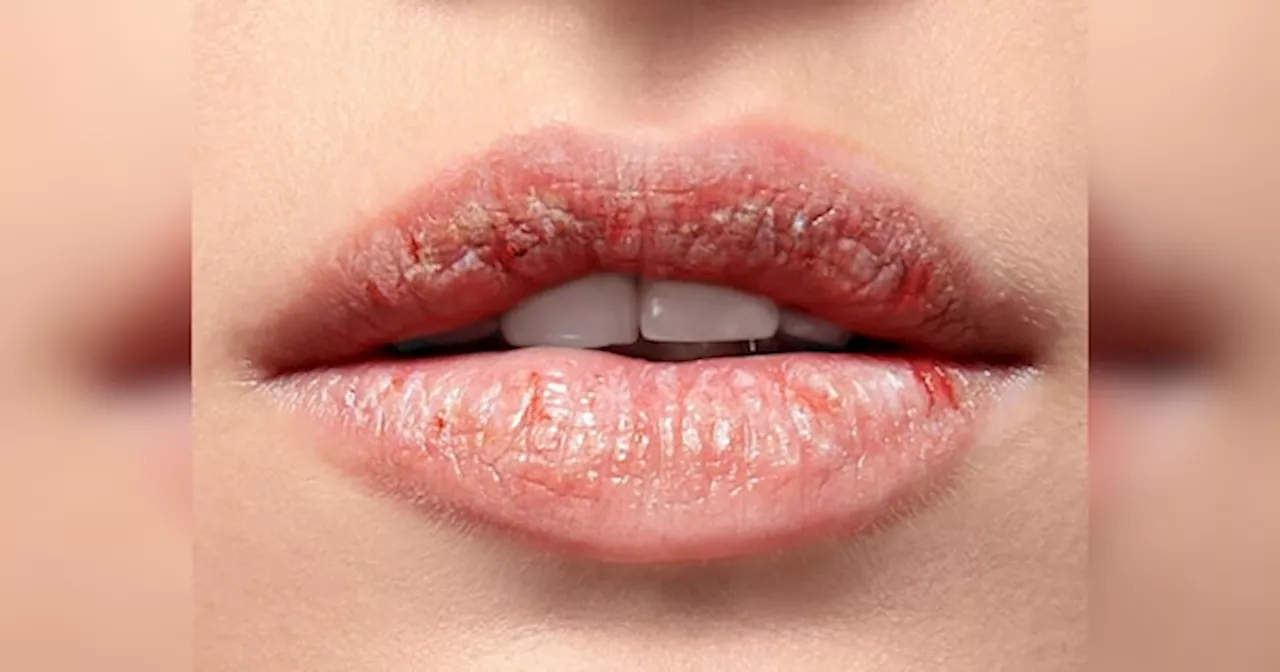 Dry Lips: इस ठंड के मौसम में ड्राई लिप्स से पाएं छुटकारा, इन पांच स्क्रब को करें ट्राई