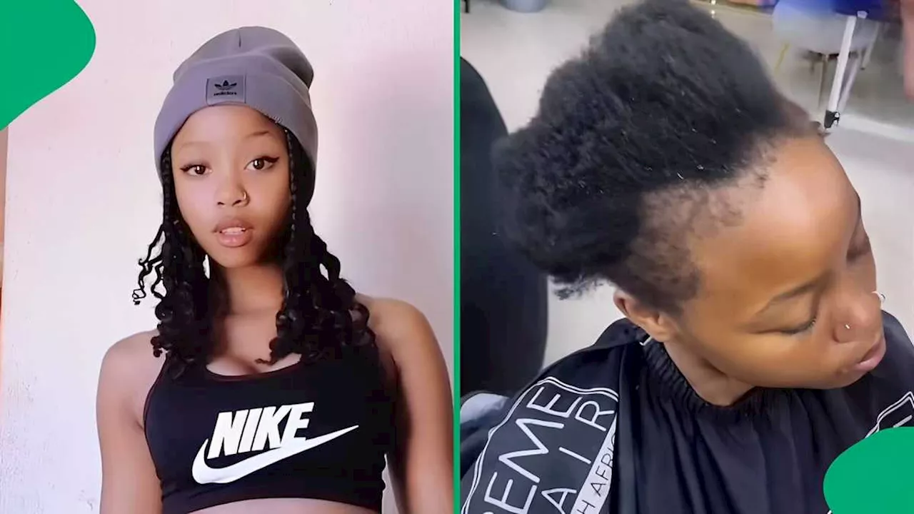 “Hairline Gone”: Mzansi Woman’s Receding Hairline Transformation Impresses South Africans