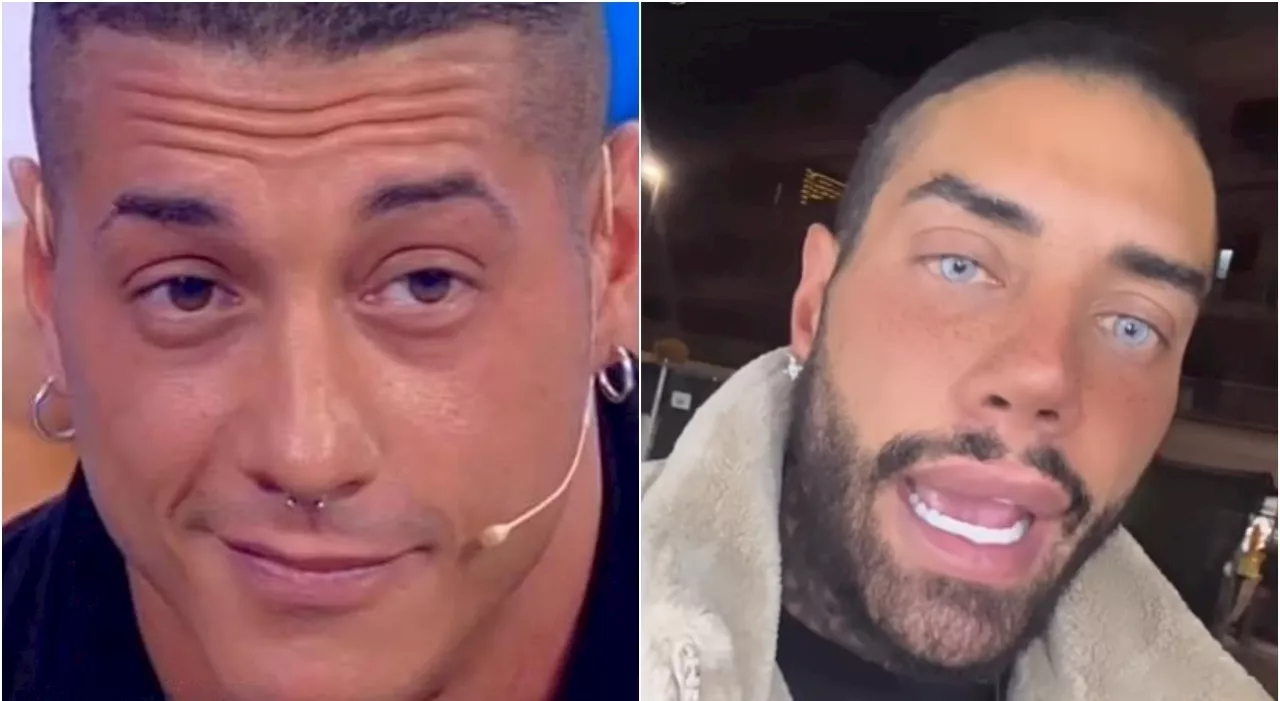 Francesco Chiofalo, com'era e com'è oggi dopo gli interventi chirurgici al viso. La trasformazione: «Non mi ri