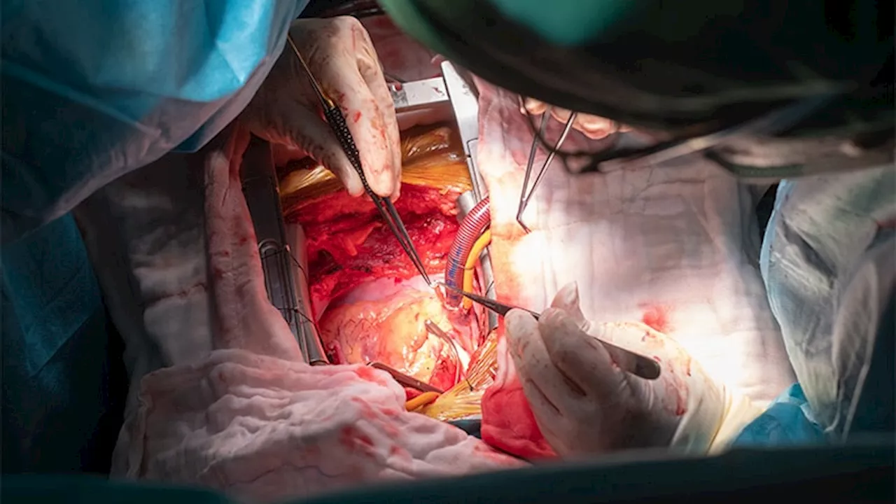 First TAVR for Aortic Regurgitation Moves to Phase 3 Trial